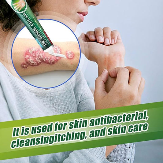 Psoriasis Cream (Original) - 20g